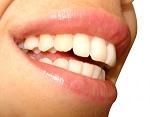 fonduri europene, implanturi dentare, proiect, finantare fonduri europene, implanturi dentare, proiect, finantare